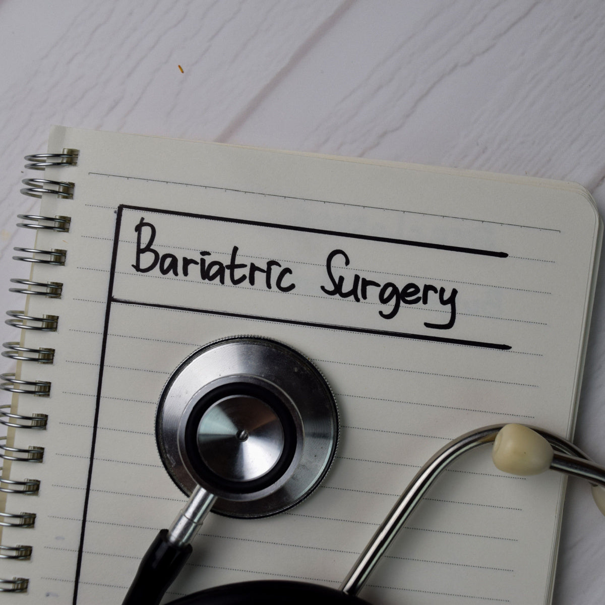 A notebook with the handwritten title "Bariatric Surgery" lies open, accompanied by a stethoscope, symbolizing the medical and emotional aspects of the bariatric surgery journey.