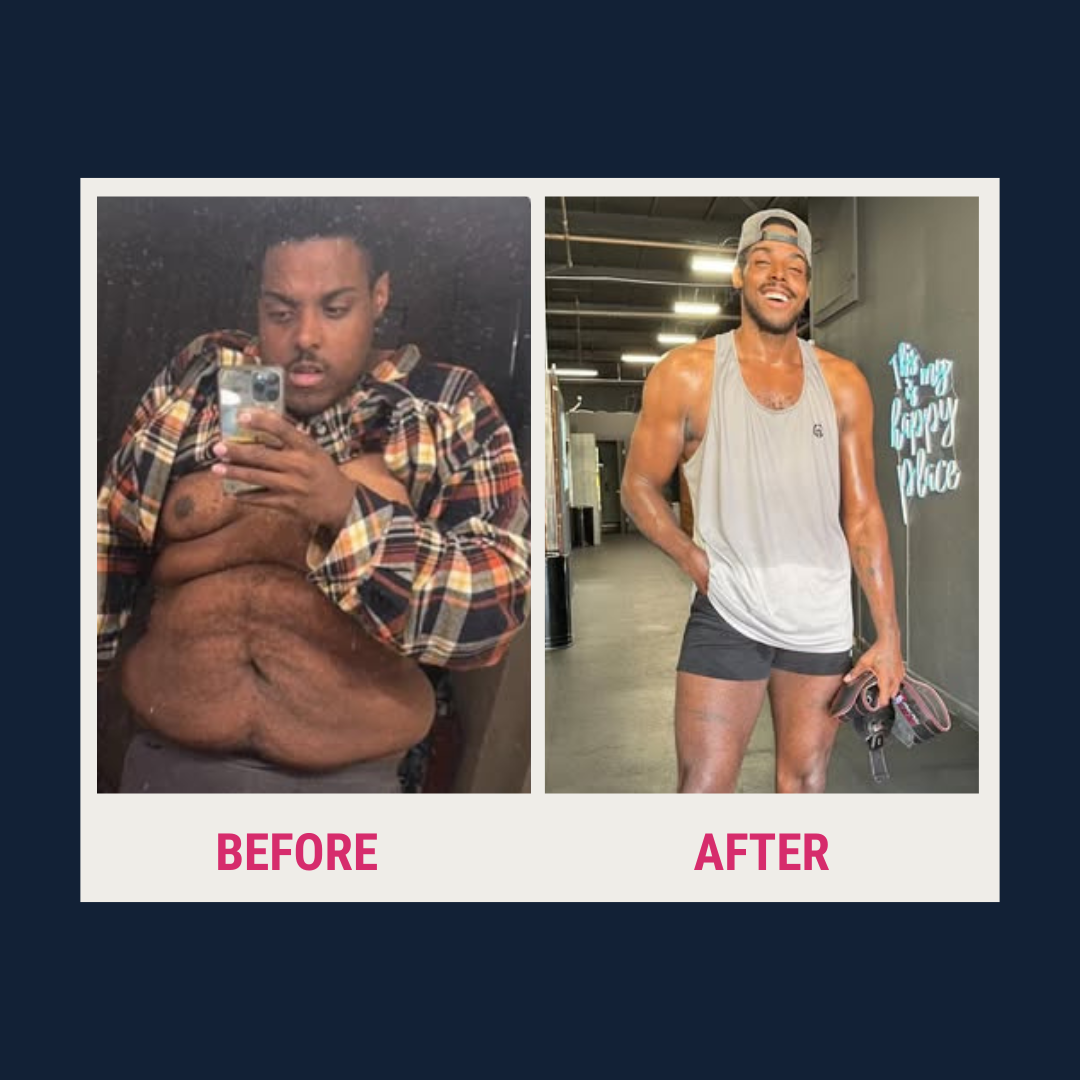 Bariatric surgery patient holding a small protein shot bottle with a confident smile