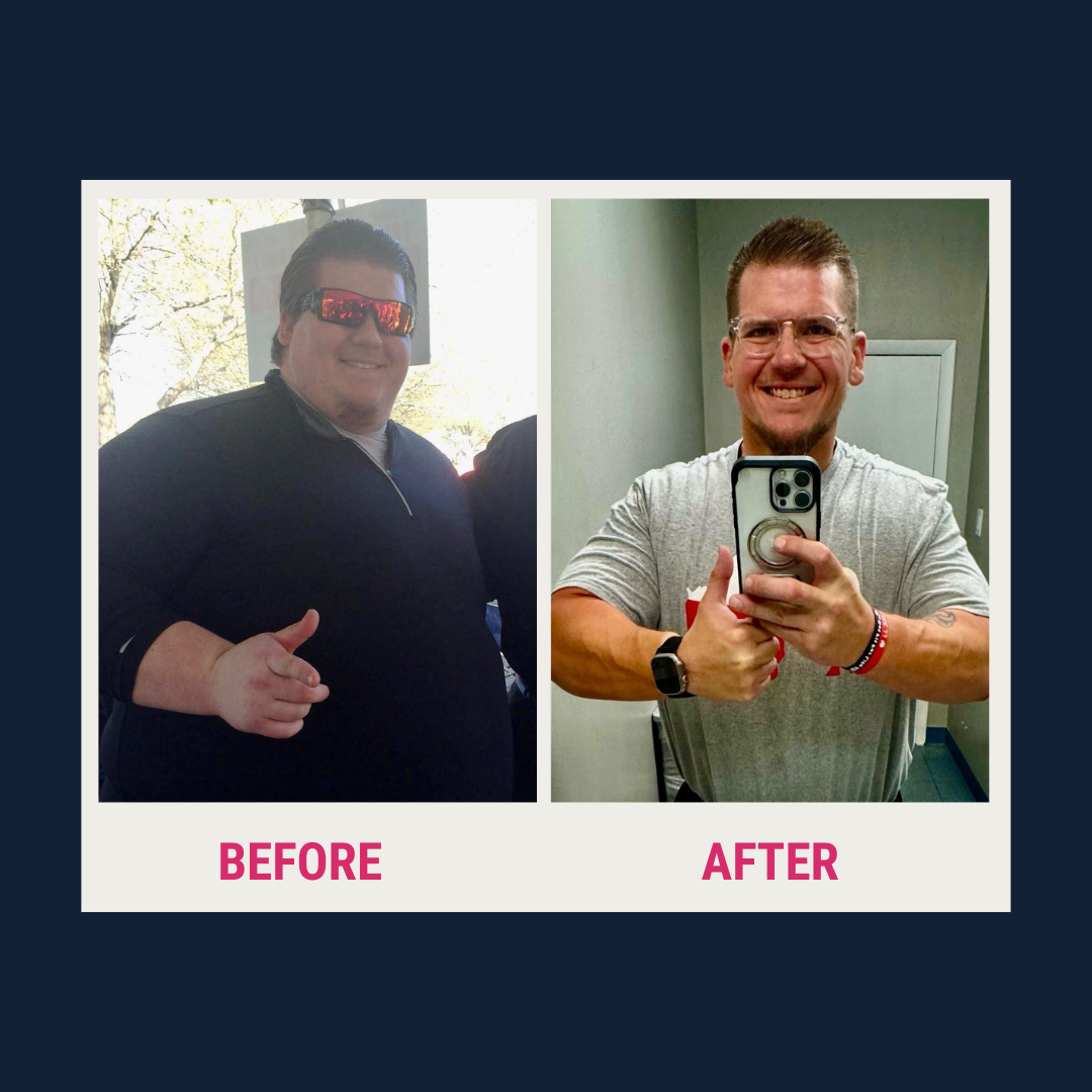 John Bergner smiling confidently after losing 374 pounds following weight loss surgery