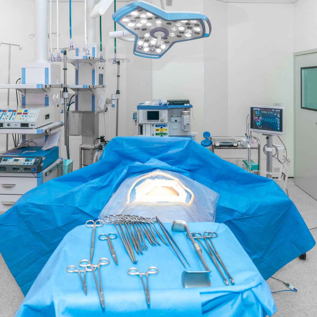 A surgical room is prepared for an operation, featuring a patient covered with blue drapes, various surgical instruments laid out on a table, and medical equipment in the background.