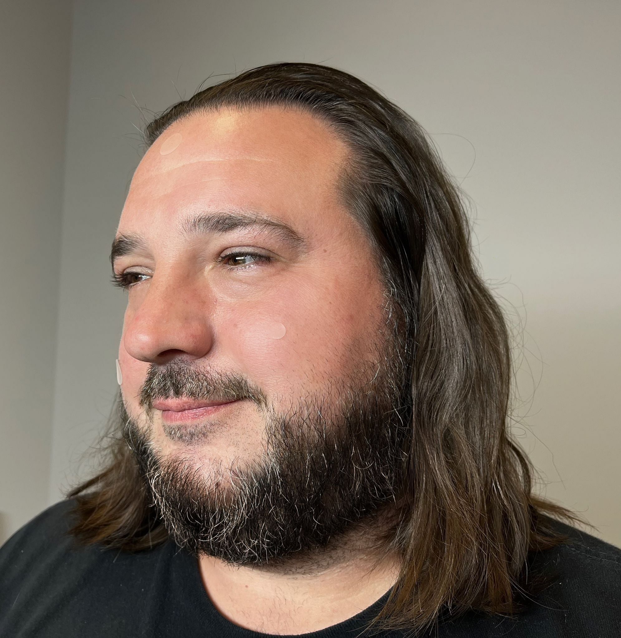 Pimple Patch Multi-Size Pack – 105 Hydrocolloid Patches in 5 Sizes with Tea Tree Oil