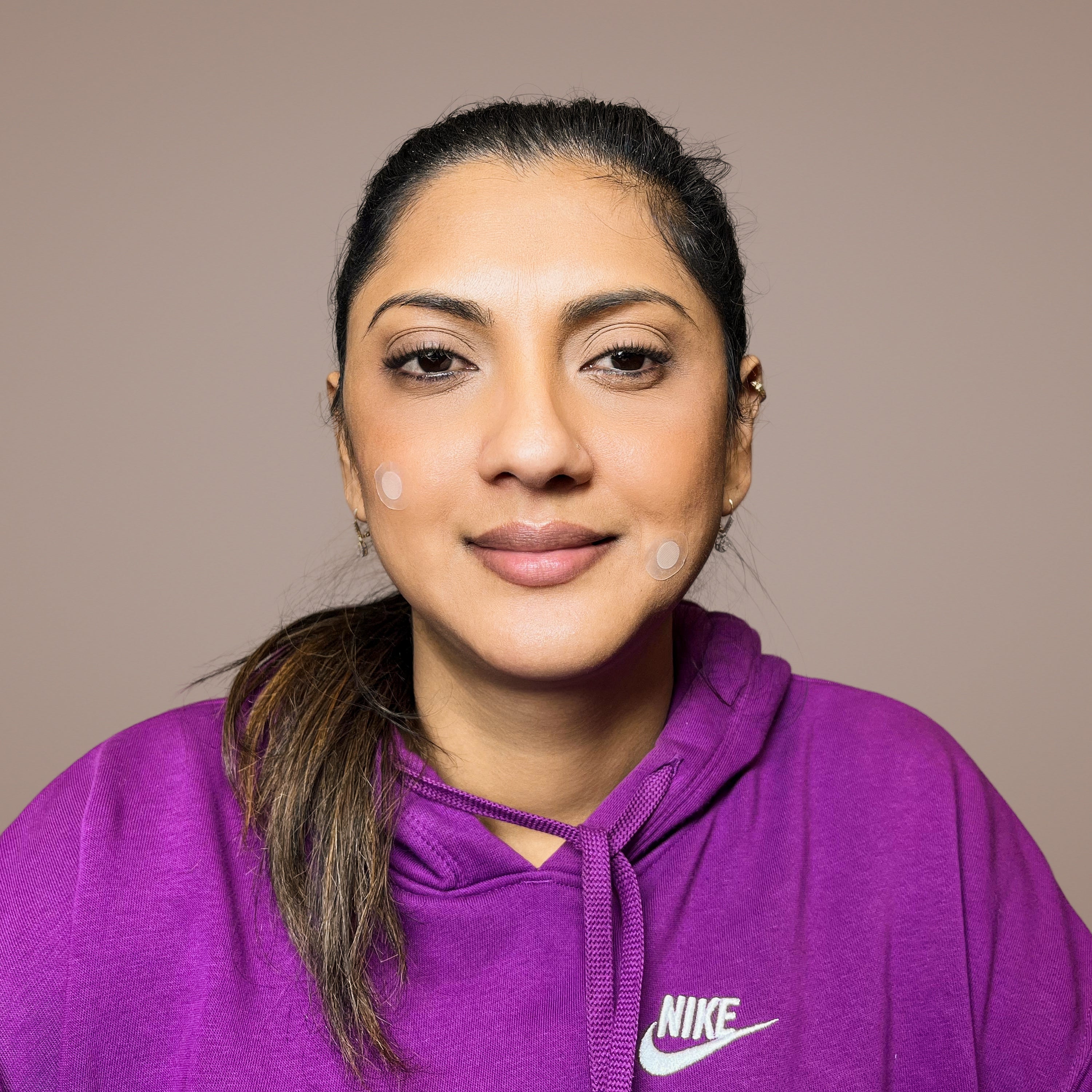 Microneedle Blemish Patch – 9 Patches with Salicylic Acid and Tea Tree Oil