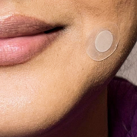 A close-up of a woman's face showing her lips and a clear acne patch applied to her cheek, indicating skincare or acne treatment in a personal care context.