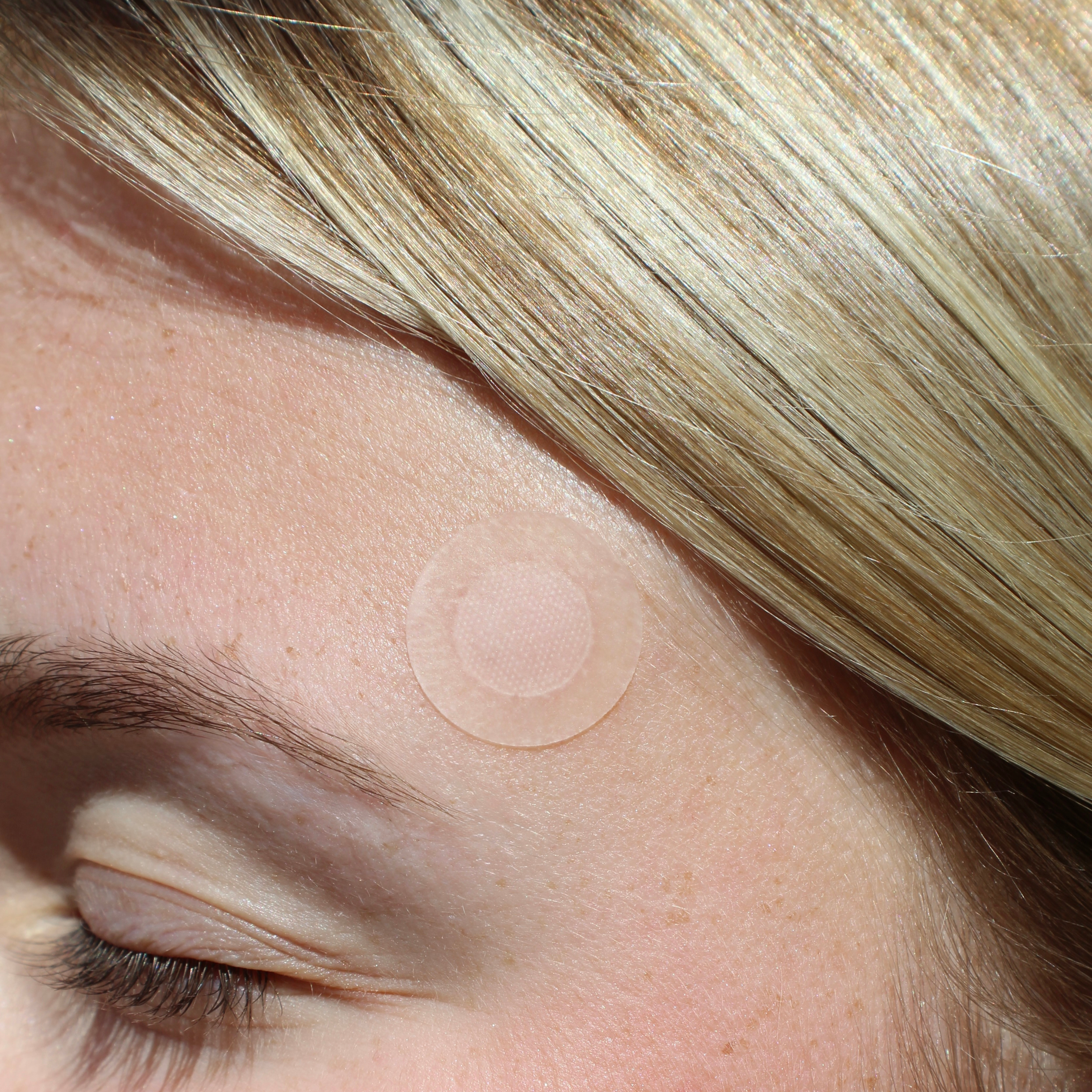 Close-up of a person's eye with a pimple patch on their face