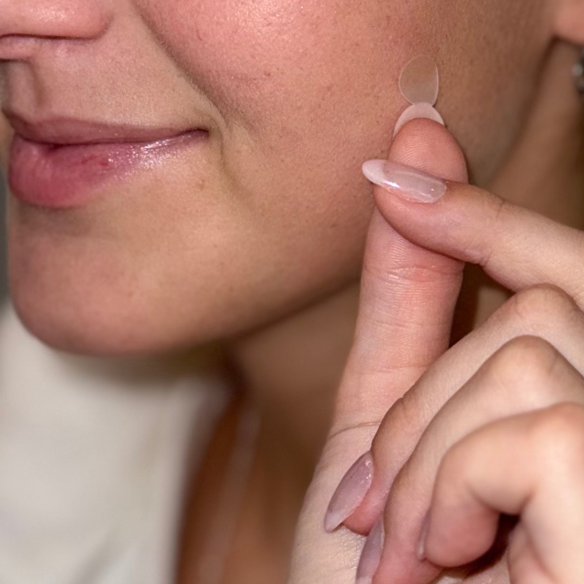 Pimple Patch Multi-Size Pack – 105 Hydrocolloid Patches in 5 Sizes with Tea Tree Oil