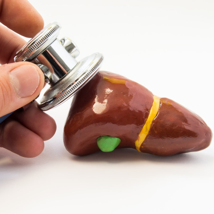 A hand holds a stethoscope against a model of a liver, which is brown with yellow and green details, symbolizing a study on the impact of bariatric surgery on liver disease risk.