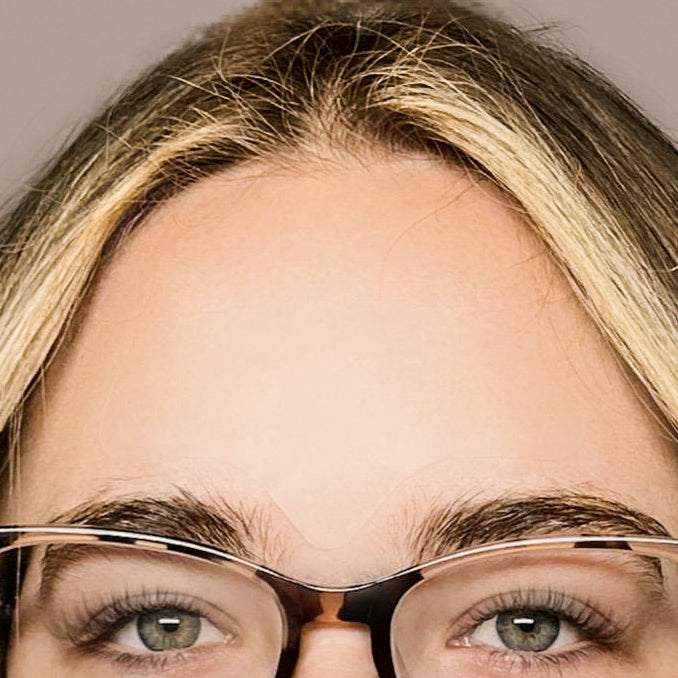 Pimple Patch Full Face – 15 Hydrocolloid Patches for Chin, Cheeks, Nose and Forehead