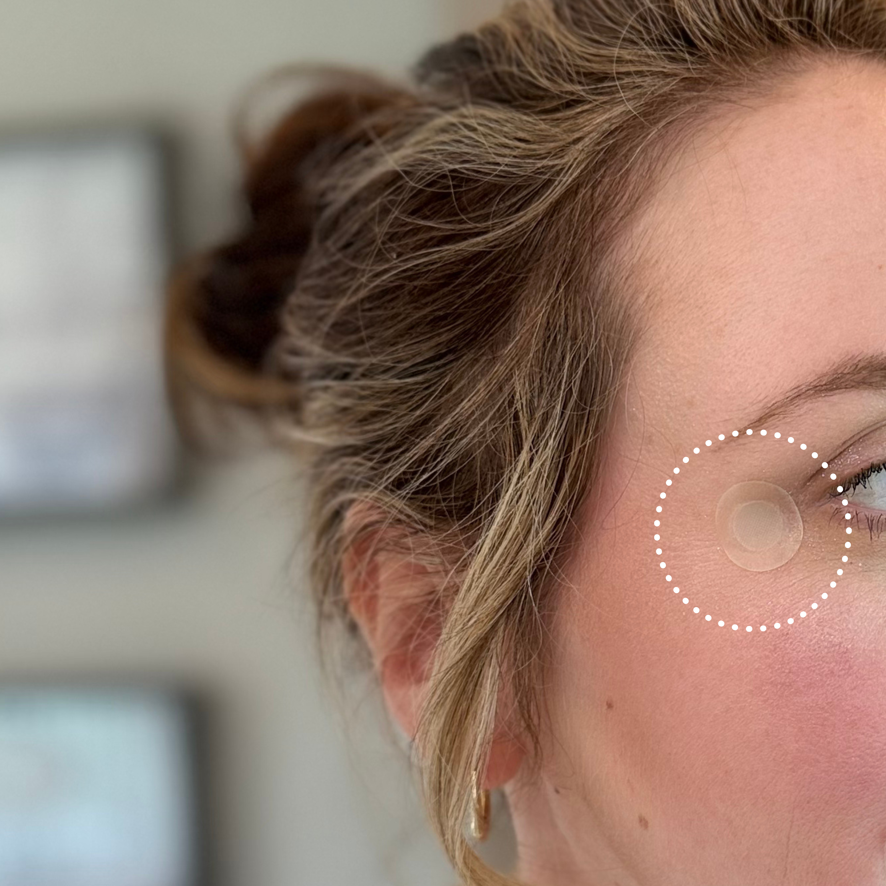 A woman with light brown hair, wearing a hoop earring, is looking to the side while a clear skincare patch is applied near her right eye, set against a softly blurred background.
