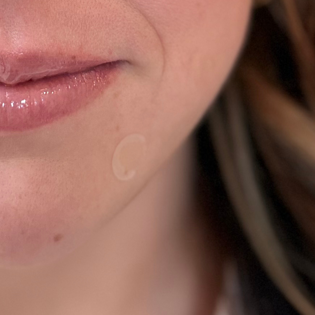 Pimple Patch Ultra – 48 Invisible Hydrocolloid Patches with Tapered Edges