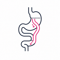 A simplified diagram of a stomach showing the digestive process with arrows indicating the flow of food through the stomach and intestines, using black and pink lines on a white background.