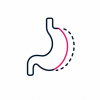 A simplified illustration of a stomach, featuring a dark outline with a pink section and a dotted line, representing an anatomical or medical concept related to digestion.