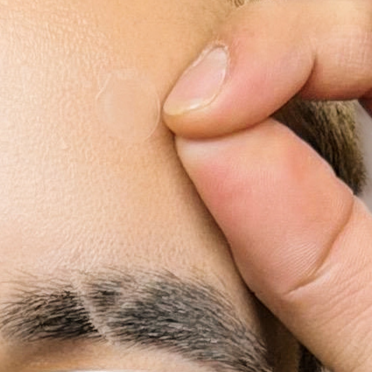 Pimple Patch Ultra – 48 Invisible Hydrocolloid Patches with Tapered Edges